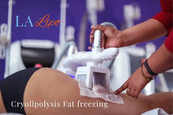 women getting fat freezing Kensington