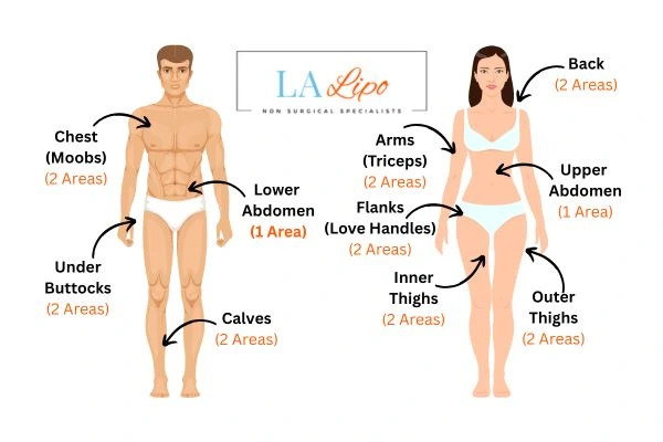 LA LIPO Cryolipolysis Areas Kensington