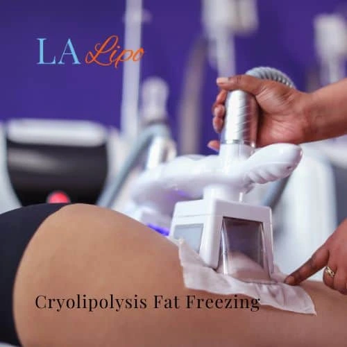 fat freezing - Cryolipolysis Kensington