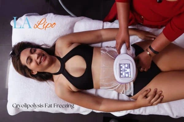 woman getting cryolipolysis Kensington