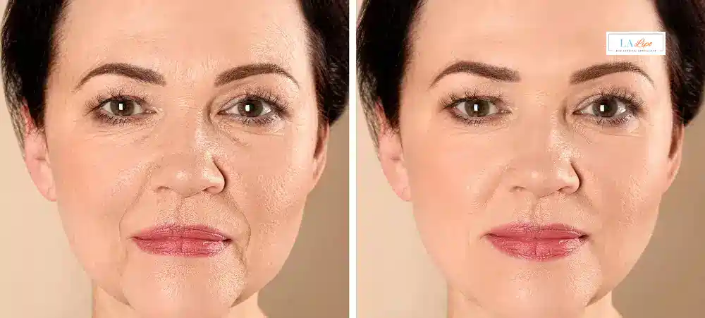 How Long Does It Take to See Results and How Long Do They Last Kensington?