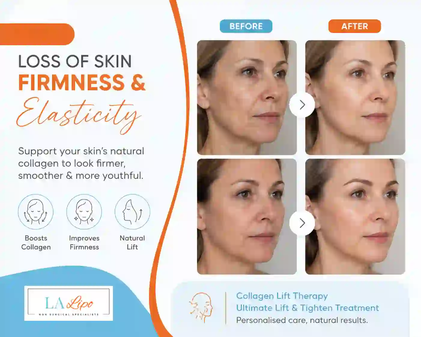 Sign #7: Loss of Skin Firmness and Elasticity Kensington